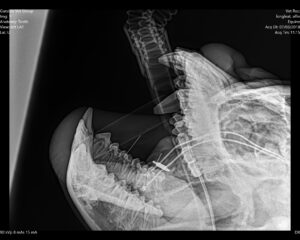 Gorilla mouth xray